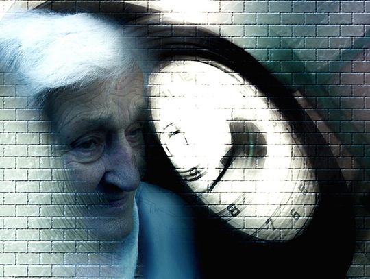 Alzheimer