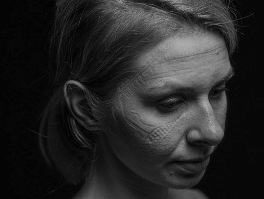 Bolesławiecka pielęgniarka na zwycięskiej fotografii