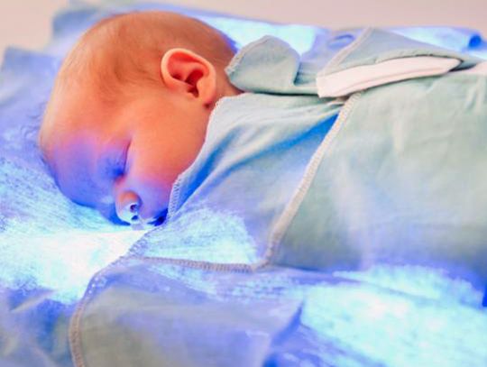 Nowoczesna fototerapia na pediatrii